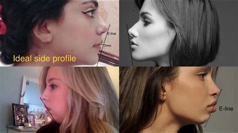 side profile|what is side profile meaning.